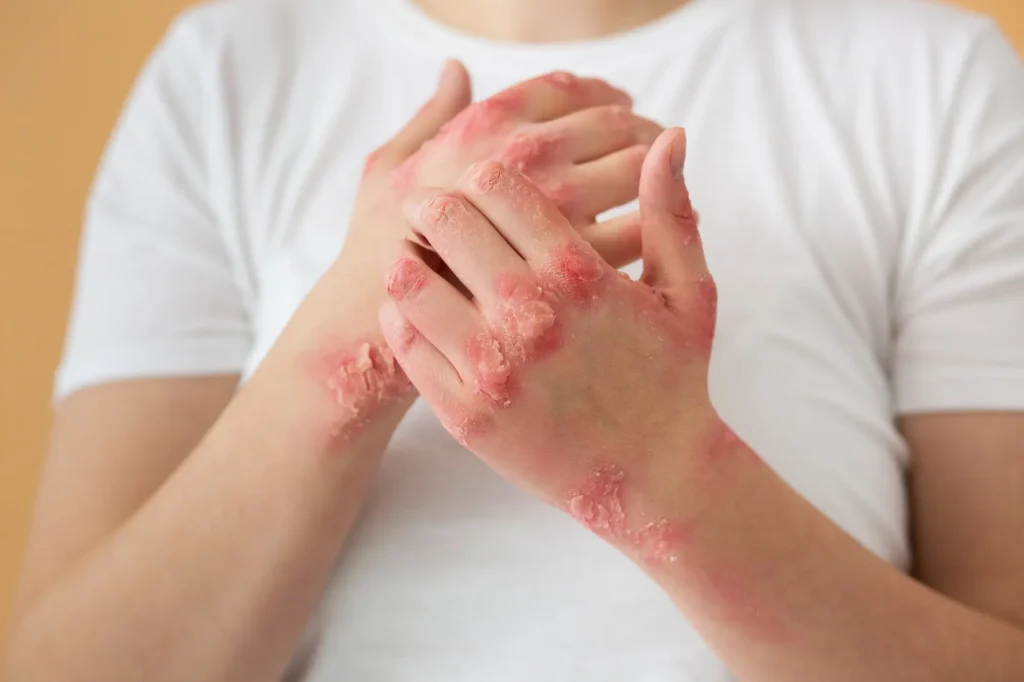 Wound Skin Conditions 1024x682